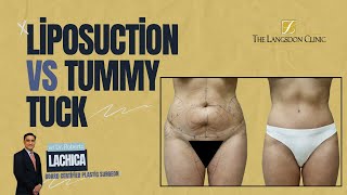 The Surprising TRUTH About Liposuction vs Tummy Tuck [upl. by Screens]