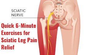 The Best Exercises for Sciatic Leg Pain Relief [upl. by Redlac]