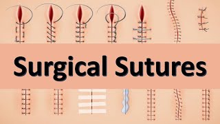 Surgical Sutures  Classification Types Examples and Uses of Surgical Sutures [upl. by Puett]