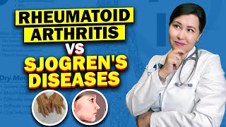 The Hidden Connection Between Rheumatoid Arthritis and Sjogrens Syndrome [upl. by Yriek]