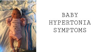 Baby Hypertonia Symptoms [upl. by Marilla]