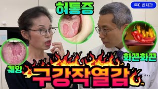 🔥구강작열감증후군혀통증 혓바닥통증 입술통증 입천장통증🔥입안 화끈화끈 따가운 통증에 몸이 덜덜덜 심한 구강건조증 미각둔화 하는 3차신경통 증상 I 루이빈치과 류지헌원장 [upl. by Irmgard]