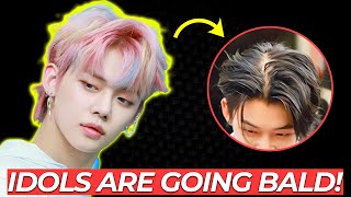 KPop Hair Pandemic  KPop Idols Are Going Bald [upl. by Kcor]