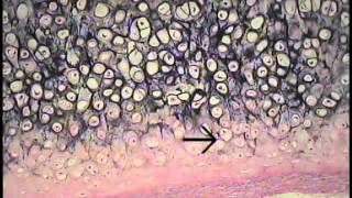 Cartilage and Bone Histology FreeMedEd [upl. by Nimesh]