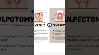 Difference between pulpotomy and pulpectomy dental dentistry dentistrystudent doctor dentist [upl. by Otreblanauj928]