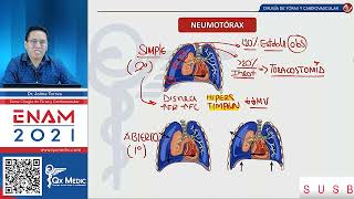 Neumotórax simple abierta y a tensión  Qx medic neumerology [upl. by Llerrat]