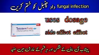 Terbiderm Terbinafine 250MG Tablet Uses Side Effects In Urdu Hindi  Fungal Infection On Skin hair [upl. by Slaughter]