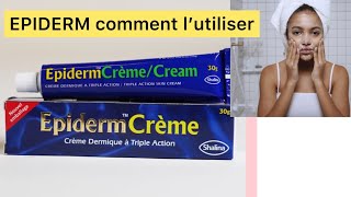 EPIDERM Crème 🥰comment l’utiliser [upl. by Ib377]