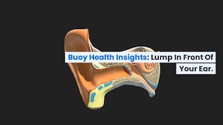 Lump in Front of Your Ear Common Causes and When to Seek Medical Care  BuoyHealthcom [upl. by Euqinor]