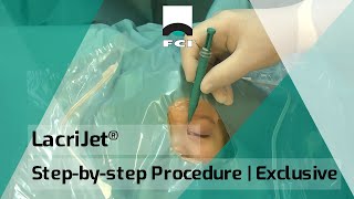 LacriJet®  Preloaded amp SelfRetaining Monocanalicular Nasolacrimal Intubation  Surgical Procedure [upl. by Naicul703]