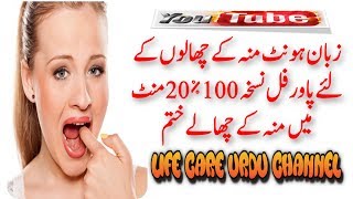 Mouth Blisters Treatment In Urdu   Blister In Mouth Treatment  Muh Ke Chalo Ka Ilaj [upl. by Standford]