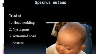 Whats Spasmus nutanshead nodding Torticollisnystagmusoptic gliomaAED vitamin DIron treatment [upl. by Elspeth]