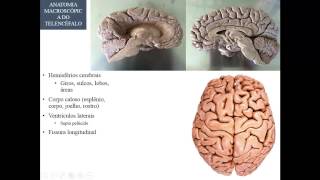 ANATOMIA MACROSCÓPICA DO SNC PARTE 3  TELENCÉFALO [upl. by Yesor]