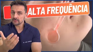 COMO APLICAR ALTA FREQUÊNCIA  DR JOÃO TASSINARY [upl. by Allare]