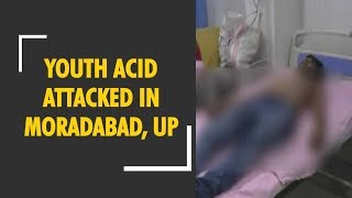 India Youth acid attacked in Moradabad UP [upl. by Yraccaz454]