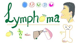 Lymphoma Introduction  Painless Enlarged Lymph Node  Hematology and Oncology Series [upl. by Daphna]