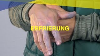 Erfrierung  MAUS Erste Hilfe Kurs  Video Tutorial [upl. by Aerdnak]