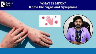 Monkeypox rash on skin  MPox Symptoms amp Diagnosis Mpox PhasesDrLeela Mohan P V RDoctors Circle [upl. by Yaresed85]