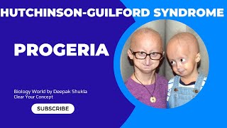 Progeria  Progeria disease  progeria  progeriasyndrome  Hutchinson Guilford Syndrome [upl. by Soracco]