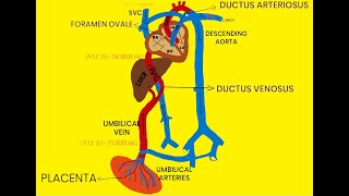 Fetal Echocardiography Basics Ultrasound  Dr Anirudh Badade [upl. by Tjader]