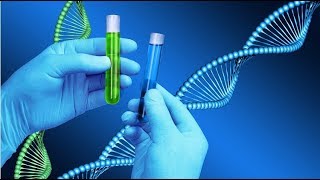 Anti Double Strand DNA Test [upl. by Petronilla]