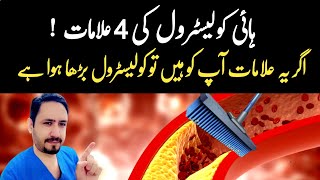 4 Warning Signs of High Cholesterol  Dr Irfan Azeem [upl. by Courtund]