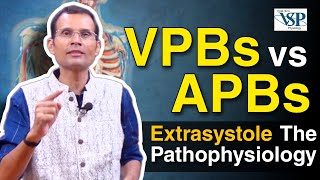 Extrasystole  The pathophysiology VPBs vs APBs  MBBS  NEET PG  Dr Vivek Nalgirkar [upl. by Kurtzig]