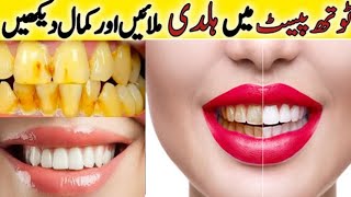 Fastest Way To Whiten Teeth At Home  What REALLY Works [upl. by Krusche251]