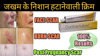 Contractubex Gel review पुराने से पुराने scars Marks को जड़ से मिटा देता है ये जेल।। [upl. by Aikemehs]