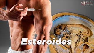 ¿Qué le hacen los esteroides a tu cuerpo [upl. by Aya]