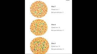 How to interpret the Ishihara test colourvision ishihara interpretation [upl. by Foushee]