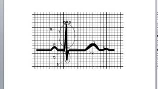 Basic Cardiology Cardiac Cycle Action Potential and the QRS Complex [upl. by Artinad346]