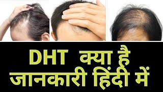 DHT kya Hai Hindi  DHT क्या है और कैसे यह बाल झाड़ने का कारण बनता है [upl. by Melvin]