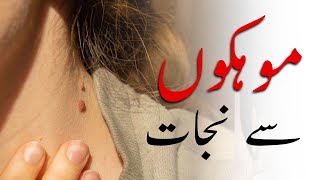 How to Rid Skin Tags and Warts  Remove Skin Tags Quickly  Urdu Hindi [upl. by Antoinetta441]