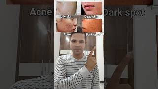 Keracyclic face wash for Acne amp oily skin ✨ skincare clearskin glowingskin beauty shorts [upl. by Anuska]