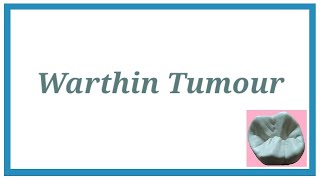 Warthin Tumour  Important Notes  Tumours of Salivary Gland 1  Oral Pathology [upl. by Ynahirb]