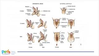 Ambiguous Genitalia [upl. by Terej]