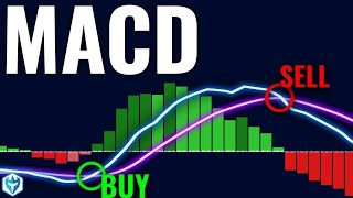 How I Nailed Trading with the MACD Indicator StepbyStep Guide [upl. by Aiceled912]