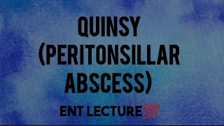 Quinsy lecture  Peritonsillar abcess  Ent lecture [upl. by Arihk538]