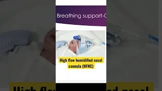 Baby on high flow humidified nasal cannula HFNC nicu neonatal neonatology ventilation HFNC [upl. by Romano]