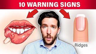 10 WARNING Signs That Your Stomach Acid Is Low [upl. by Vaules]