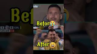 Messi Crying after Injury😭💔  Argentina vs Colombia 10 Copa America Final shorts argentina viral [upl. by Abert]