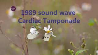 Rife Frequency  Cardiac Tamponade  Binaural Beats  1989 sound wave [upl. by Namra726]