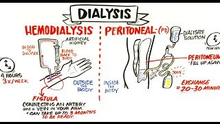 Failing Kidneys and Different Treatment Options [upl. by Asuncion]