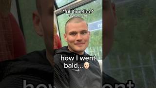 How I went bald… [upl. by Aryek]