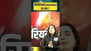 सिजेरियन का सच  CESAREAN BIRTH क्यों और कैसे होता है ShortsFeed CesareanBirth Science PW [upl. by Eidac813]