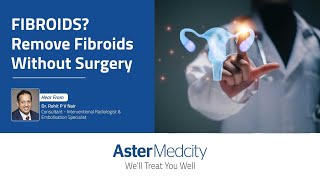 No More Surgeries For Fibroids [upl. by Leodora]