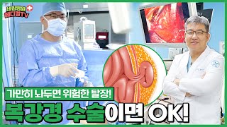 부평세림병원 가만히 놔두면 장이 썩어가는 ‘탈장’ 복강경 수술이면 OK [upl. by Assereht851]