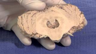 The Cerebellum Neuroanatomy Video Lab  Brain Dissections [upl. by Lorn237]