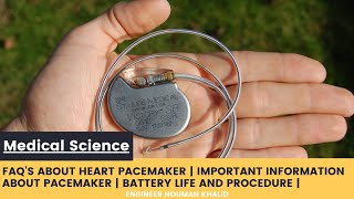 Common Questions about Heart Pacemaker  FAQs about Heart Pacemaker [upl. by Snider776]